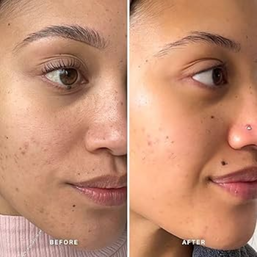 Muse Labs 7% Glycolic Acid Toner | Exfoliating Solution with 5D Hyaluronic Acid & Peptides | Smooth, Bright & Hydrated Skin